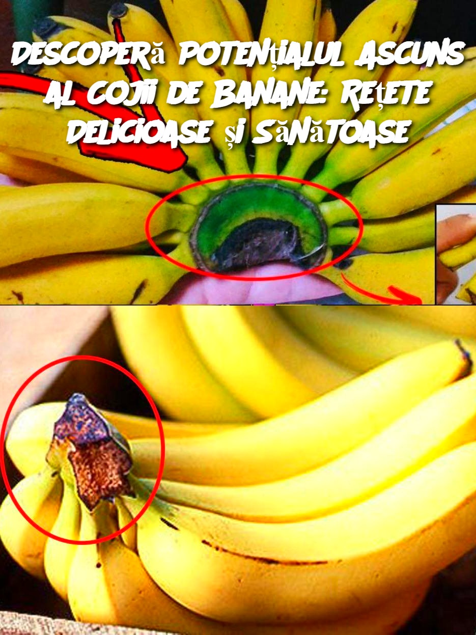 Descoperă Potențialul Ascuns al Cojii de Banane: Rețete Delicioase și Sănătoase